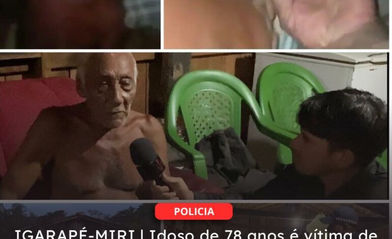  IGARAPÉ-MIRI | Idoso de 78 anos é vítima de maus-tratos e aparece acorrentado em vídeo